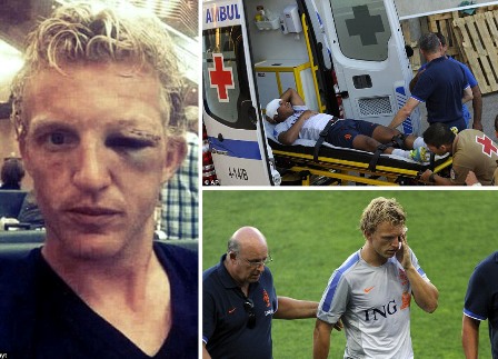 Kuyt, Matanya Lebam Akibat Benturan dengan De Guzman